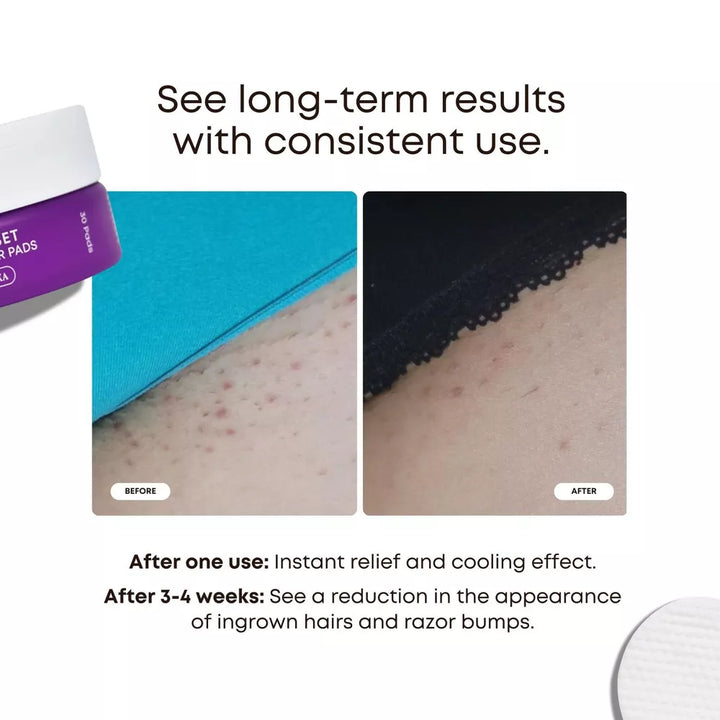 Radiant Reset Exfoliating Toner Pads